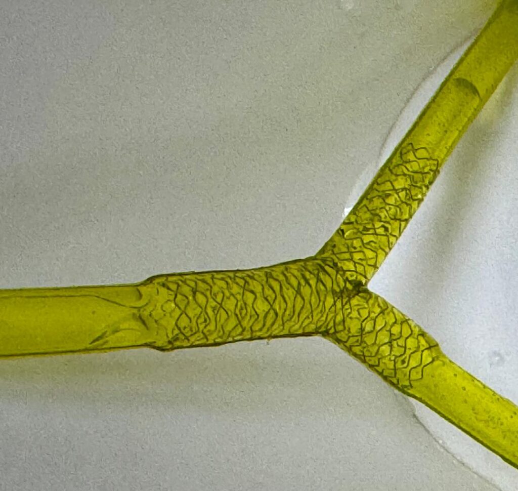 Bifurcation Stenting